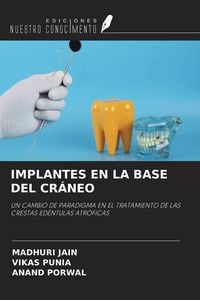 Produktbild: IMPLANTES EN LA BASE DEL CR&Aacute;NEO