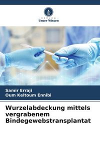 Produktbild: Wurzelabdeckung mittels vergrabenem Bindegewebstransplantat