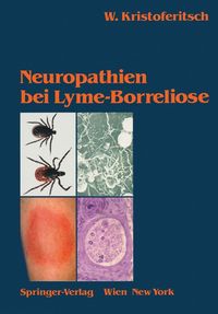 Produktbild: Neuropathien bei Lyme-Borreliose