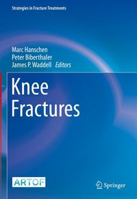 Produktbild: Knee Fractures