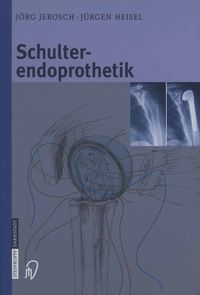 Produktbild: Schulterendoprothetik