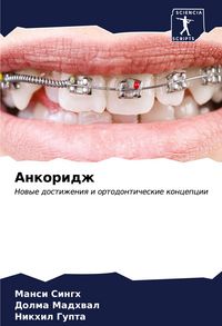 Produktbild: Ankoridzh