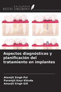 Produktbild: Aspectos diagn&oacute;sticos y planificaci&oacute;n del tratamiento en implantes