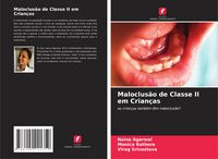 Produktbild: Maloclus&atilde;o de Classe II em Crian&ccedil;as