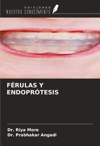 Produktbild: F&Eacute;RULAS Y ENDOPR&Oacute;TESIS