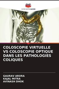 Produktbild: Coloscopie Virtuelle Vs Coloscopie Optique Dans Les Pathologies Coliques