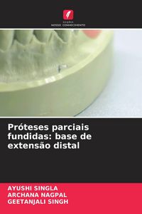 Produktbild: Pr&oacute;teses parciais fundidas: base de extens&atilde;o distal