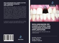 Produktbild: Mislukkingen En Complicaties Van Tandheelkundige Implantaten
