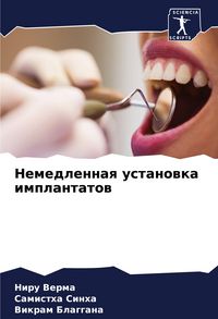 Produktbild: Nemedlennaq ustanowka implantatow