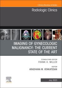 Produktbild: Imaging of Gynecologic Malignancy: The Current State of the Art, an Issue of Radiologic Clinics of North America
