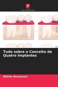 Produktbild: Tudo sobre o Conceito de Quatro Implantes