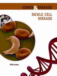 Produktbild: Jones, P:  Sickle Cell Disease
