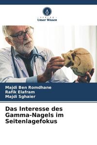 Produktbild: Das Interesse des Gamma-Nagels im Seitenlagefokus