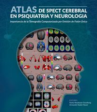 Produktbild: Atlas de spect cerebral en psiquiatria y neurolog&iacute;a