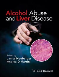 Produktbild: Alcohol Abuse and Liver Disease