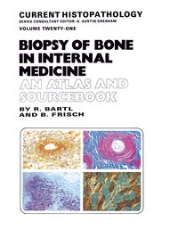 Produktbild: Biopsy of Bone in Internal Medicine: An Atlas and Sourcebook