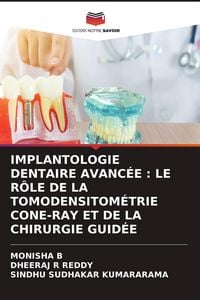 Produktbild: IMPLANTOLOGIE DENTAIRE AVANC&Eacute;E : LE R&Ocirc;LE DE LA TOMODENSITOM&Eacute;TRIE CONE-RAY ET DE LA CHIRURGIE GUID&Eacute;E