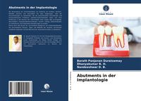 Produktbild: Abutments in der Implantologie