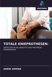 Produktbild: Totale Knieprothesen: