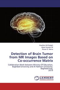 Produktbild: Detection of Brain Tumor from MR Images Based on Co-occurrence Matrix