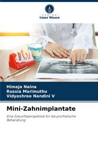 Produktbild: Mini-Zahnimplantate
