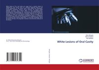 Produktbild: White Lesions of Oral Cavity