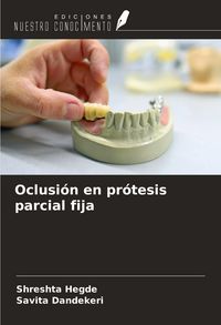 Produktbild: Oclusi&oacute;n en pr&oacute;tesis parcial fija