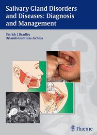 Produktbild: Salivary Gland Disorders and Diseases: