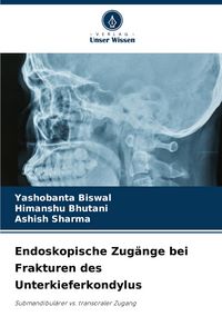 Produktbild: Endoskopische Zug&auml;nge bei Frakturen des Unterkieferkondylus