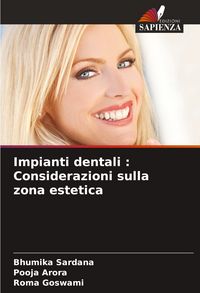 Produktbild: Impianti dentali : Considerazioni sulla zona estetica