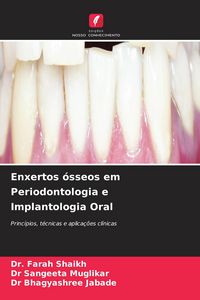 Produktbild: Enxertos &oacute;sseos em Periodontologia e Implantologia Oral