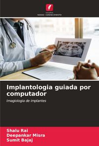 Produktbild: Implantologia guiada por computador