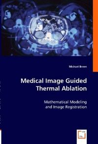 Produktbild: Breen, M: Medical Image Guided Thermal Ablation