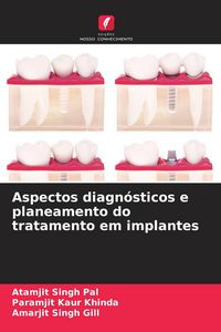 Produktbild: Aspectos diagn&oacute;sticos e planeamento do tratamento em implantes