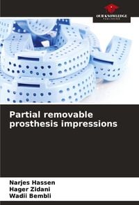 Produktbild: Partial removable prosthesis impressions