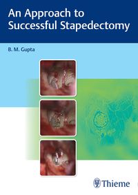 Bild vom Artikel An Approach to Successful Stapedectomy vom Autor B. Gupta
