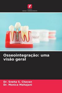 Produktbild: Osseointegra&ccedil;&atilde;o: uma vis&atilde;o geral