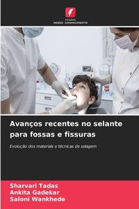 Produktbild: Avan&ccedil;os recentes no selante para fossas e fissuras