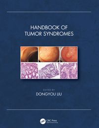 Produktbild: Handbook of Tumor Syndromes