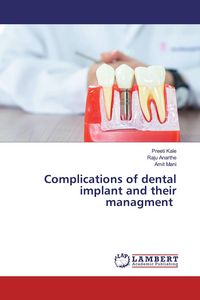 Produktbild: Complications of dental implant and their managment