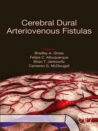 Produktbild: Cerebral Dural Arteriovenous Fistulas