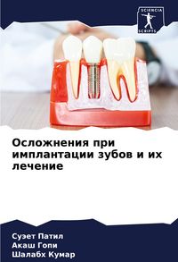 Produktbild: Oslozhneniq pri implantacii zubow i ih lechenie