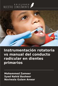 Produktbild: Instrumentaci&oacute;n rotatoria vs manual del conducto radicular en dientes primarios