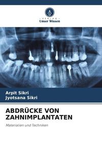 Produktbild: Abdr&uuml;cke von Zahnimplantaten