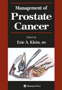 Produktbild: Management of Prostate Cancer