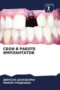 Produktbild: Sboi V Rabote Implantatov