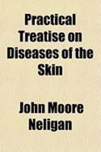 Produktbild: Practical Treatise on Diseases of the Skin
