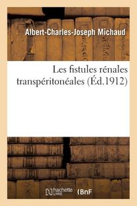 Produktbild: Les fistules r&eacute;nales transp&eacute;riton&eacute;ales