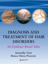 Produktbild: Diagnosis and Treatment of Hair Disorders