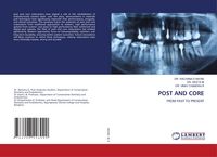Produktbild: Post and Core